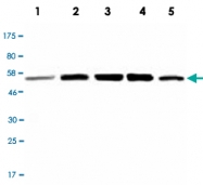 MAB2720 - CHK1
