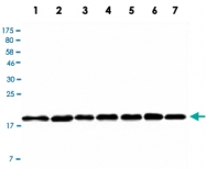 MAB2722 - Ferritin light chain (FTL)