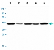 MAB2727 - NCK2