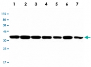 MAB2728 - PPP1CA