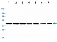 MAB2729 - PPP1CB