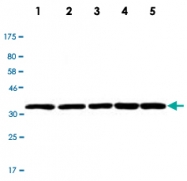 MAB2731 - LDHB