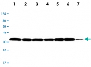 MAB2732 - LDHB