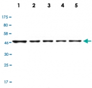 MAB2733 - Casein kinase I delta