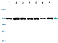 MAB2735 - Radixin / RDX
