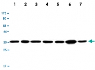 MAB2736 - LDHA