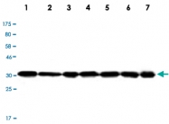MAB2737 - LDHA
