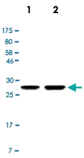 MAB2741 - Calretinin