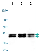 MAB2743 - PON2