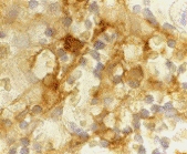 MAB2748 - CD209 / DC-SIGN
