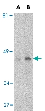 MAB2749 - CD209 / DC-SIGN