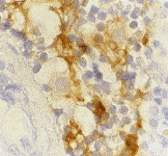 MAB2749 - CD209 / DC-SIGN