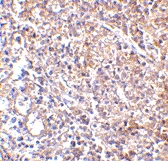 MAB2752 - MD-2