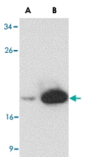 MAB2752 - MD-2