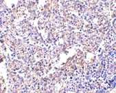 MAB2753 - MD-2