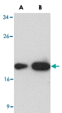 MAB2753 - MD-2