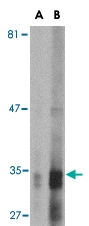 MAB2758 - Endonuclease G