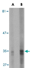 MAB2759 - Endonuclease G