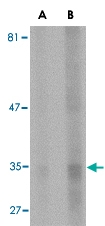 MAB2760 - Endonuclease G