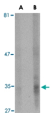 MAB2761 - Endonuclease G