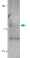 MAB2768 - Influenza A H5N1