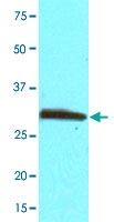 MAB3206 - PCNA