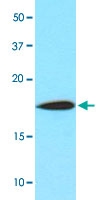 MAB3208 - Cofilin-1