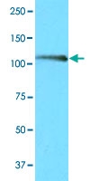 MAB3209 - NFAT2 / NFATC