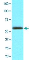 MAB3210 - PNPLA2 / ATGL