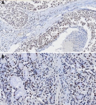MAB3210 - PNPLA2 / ATGL