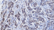 MAB3211 - RBP4