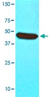 MAB3212 - ST13 / HIP