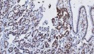 MAB3212 - ST13 / HIP