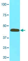 MAB3213 - MAT2A