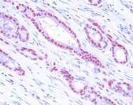 MAB3213 - MAT2A