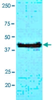 MAB3216 - CHI3L1
