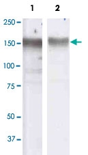 MAB3323 - EGFR / ERBB1