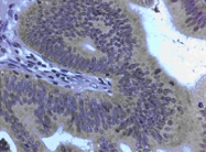 MAB3331 - MMP-3