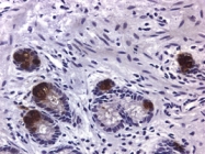 MAB3332 - MMP-9