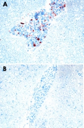 MAB3365 - CD256 / APRIL