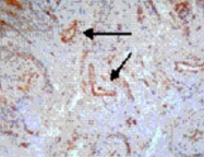 MAB3371 - CD257 / BAFF