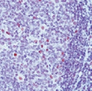MAB3381 - ERCC4