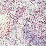 MAB3395 - XRCC6 / Ku70