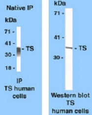 MAB3411 - Thymidylate synthase (TS)