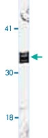 MAB3418 - XPA / XPAC