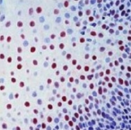MAB3418 - XPA / XPAC