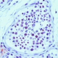 MAB3419 - XRCC1
