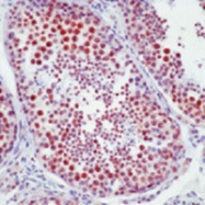 MAB3432 - DNA-PKcs / PRKDC / XRCC7