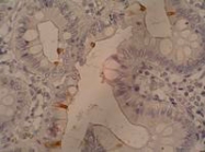 MAB3589 - CA 19-9