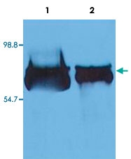 MAB3598 - Albumin